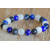 HYPERSENSIBILITE