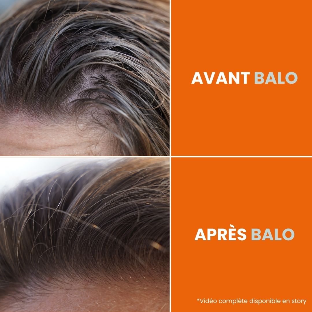 Shampoing-vendu-pharmarcie-lavage-nomade-sans-eau
