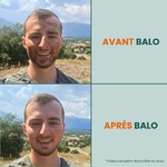 balo-Avant_Après_Gel_Douche