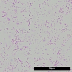 jbl-denitrol-100-ml-bacterie-microscope-aquarium