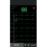 M850-ECG-7-courbes-8