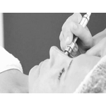 micodermabrasion.4jpg