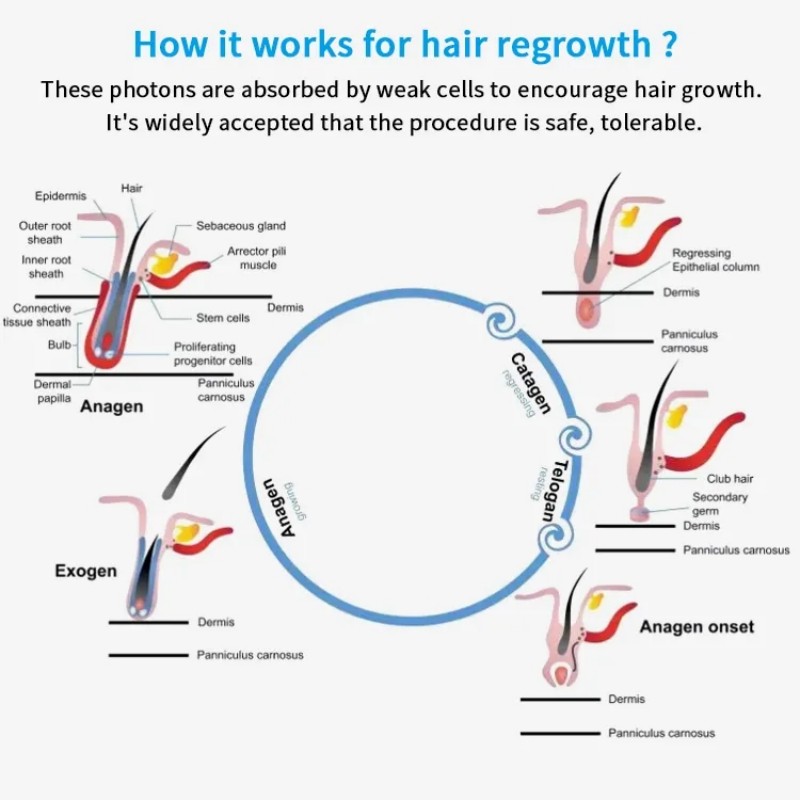 Capuchon-de-croissance-des-cheveux-au-laser-professionnel-pour-hommes-traitements-de-repousse-des-cheveux-traitements