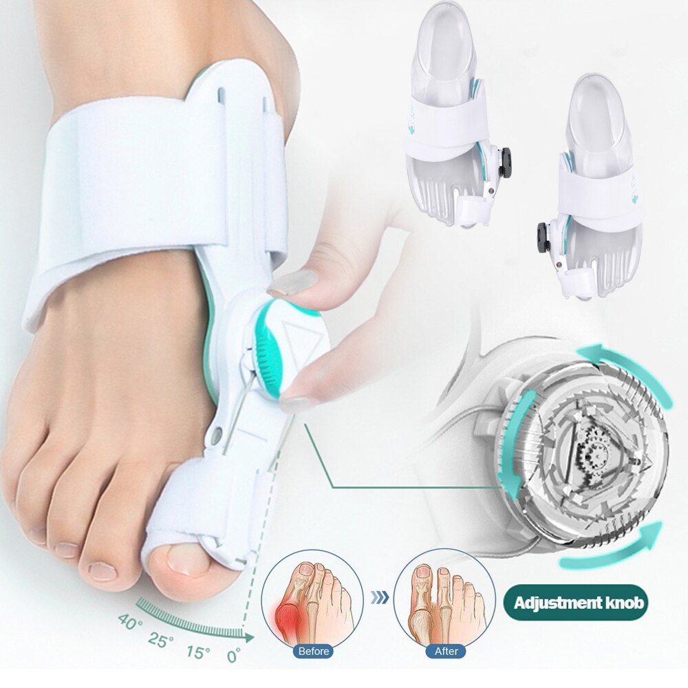 Nouveau-lisseur-d-oignon-pour-gros-orteils-bouton-correcteur-r-glable-Hallux-Valgus-fournitures-orthop-diques