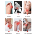 Correcteur-d-hallux-Valgus-oignon-pour-orteils-s-parateur-de-doigts-soin-des-pieds