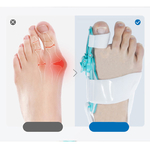 Correcteur-d-hallux-Valgus-oignon-pour-orteils-s-parateur-de-doigts-soin-des-pieds