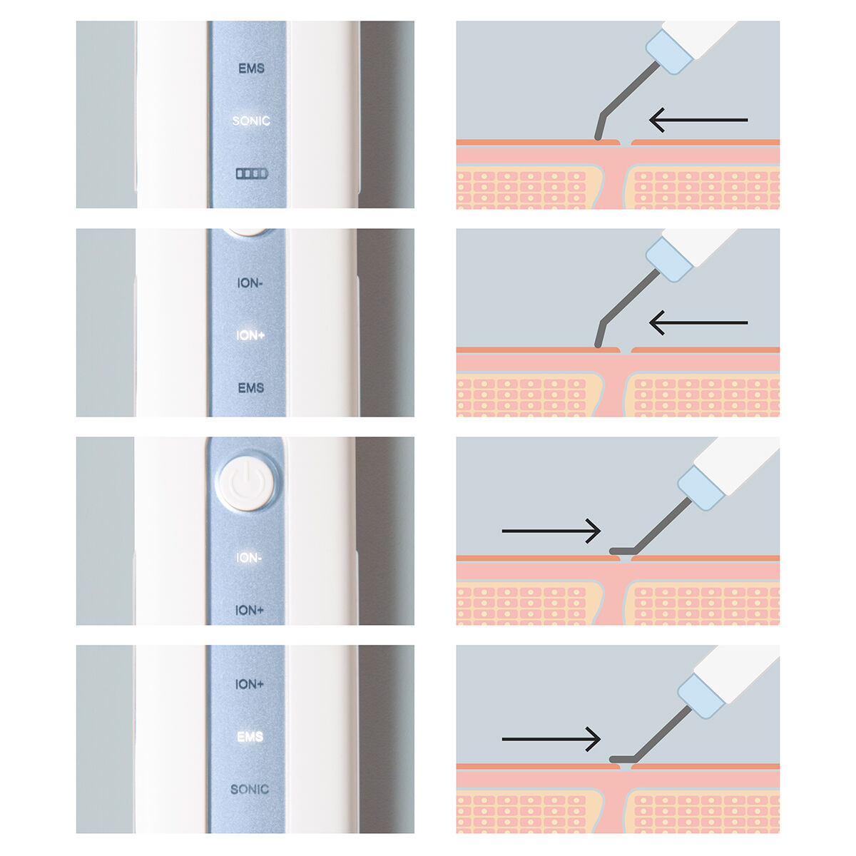 Epurateur de Peau 4 en 1 Utilisation