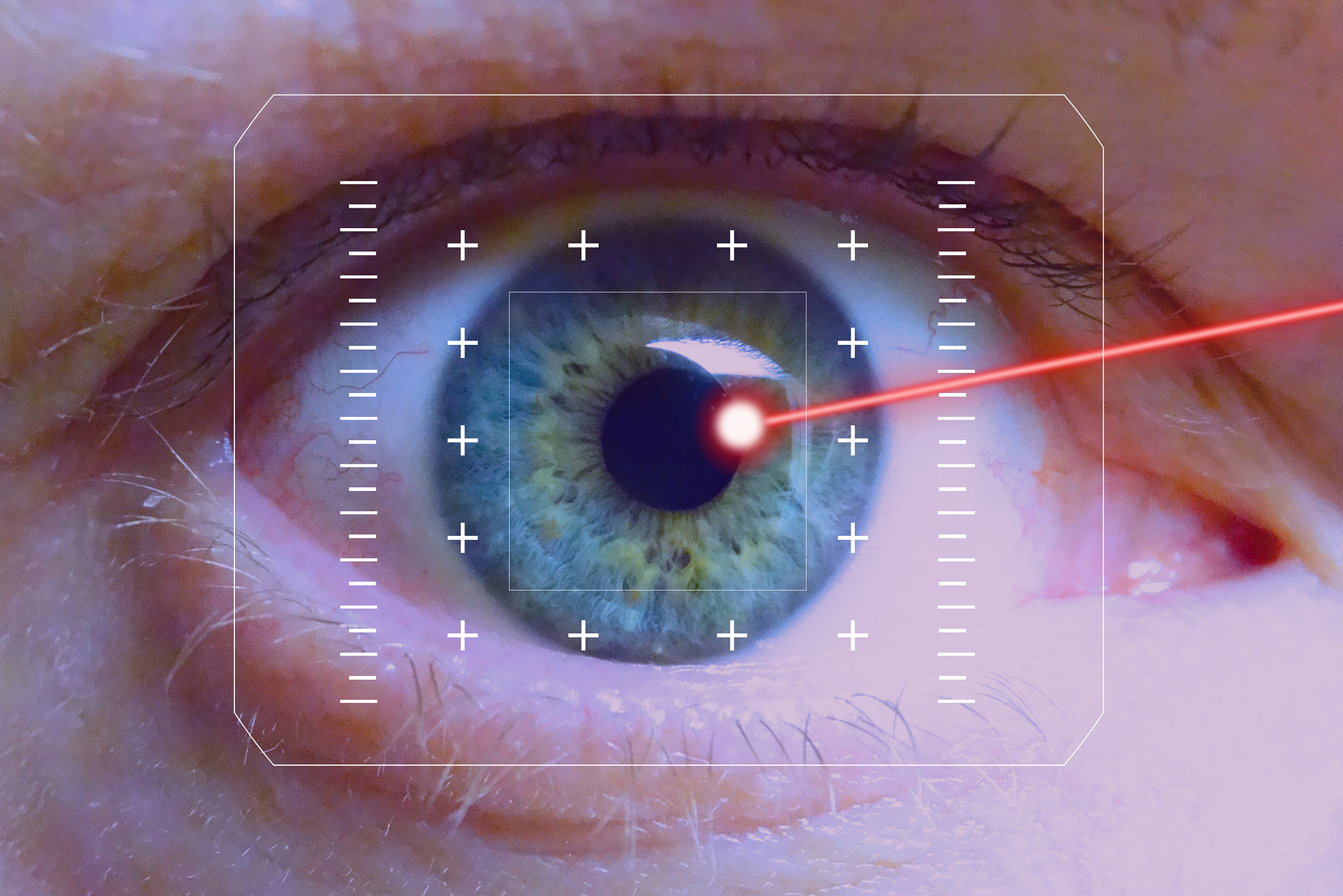 lasers 495751 1920 1