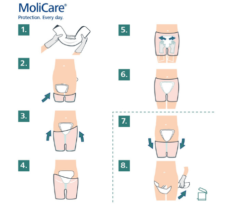 moliform 2