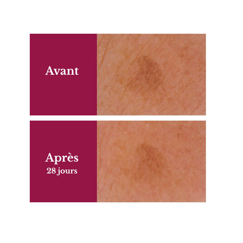 serum-concentre-anti-taches3