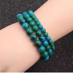 bracellllllllllllleeeeeeeeeeeeeeeeeeeeeeeeeerrrrrrrrrr