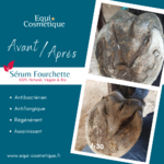 Equitnol postérieur droit
