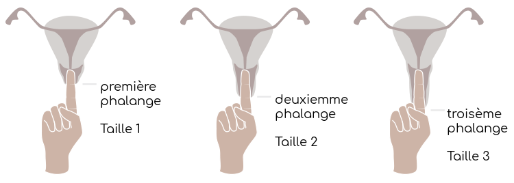 Essayez de mesurer votre col de l'utérus pour voir quelle taille est recommandée pour vous
