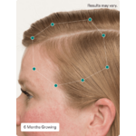 Nutrafol-Womens-Balance-After
