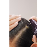 invati-advanced-scalp-1