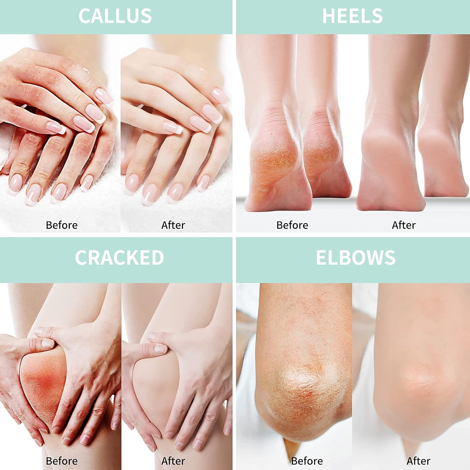 CRÈME PIEDS 40% URÉE 6
