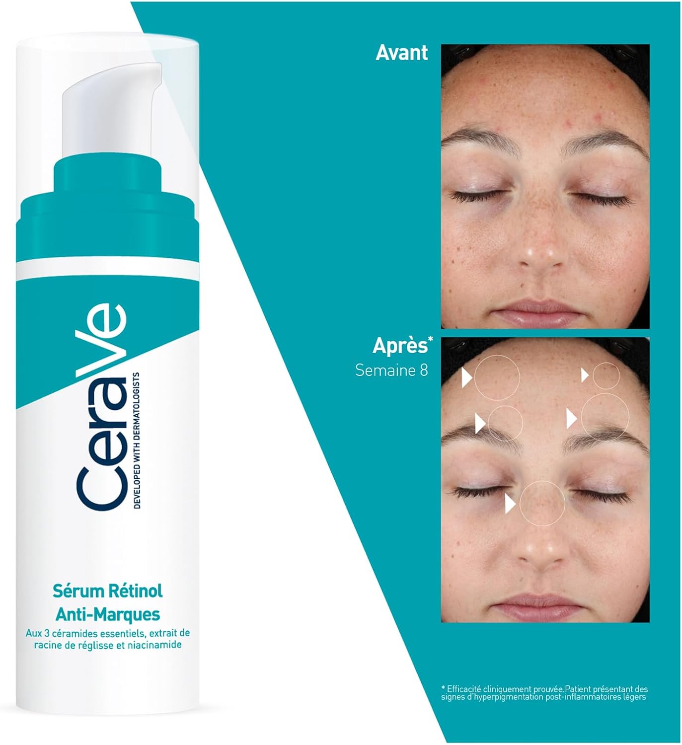 CeraVe sérum rétinol anti-marques 4
