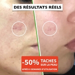 Sérum Vitamine C Acide Hyaluronique 4