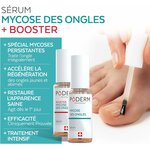 Traitement mycose ongle 2