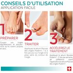 Traitement mycose ongle 6