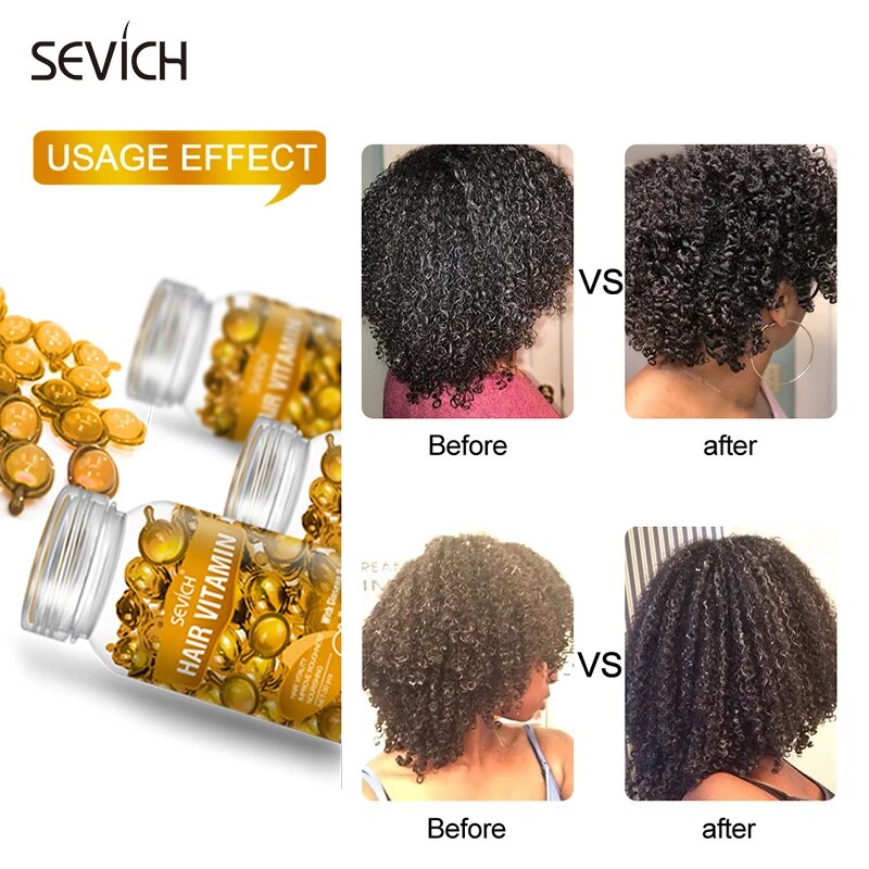 Priority-ich-Hair-Capsule-d-huile-de-vitamine-KerBrian-r-paration-anti-chute-de-cheveux-boucles