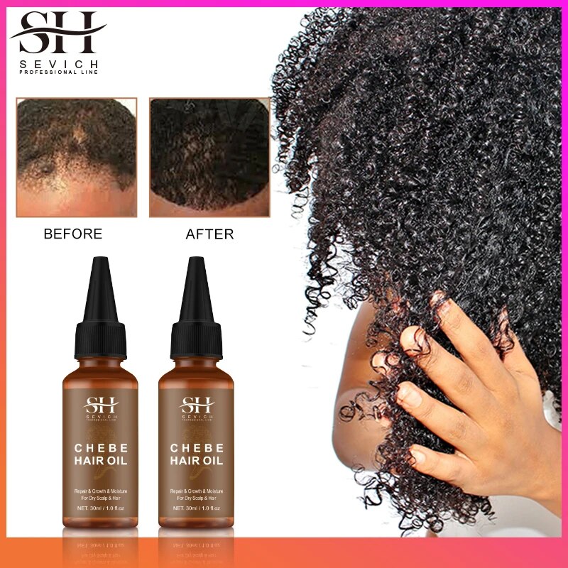 Ensemble-de-traitement-de-croissance-rapide-des-cheveux-Priority-ich-Chebe-Spray-anti-chute-de-cheveux