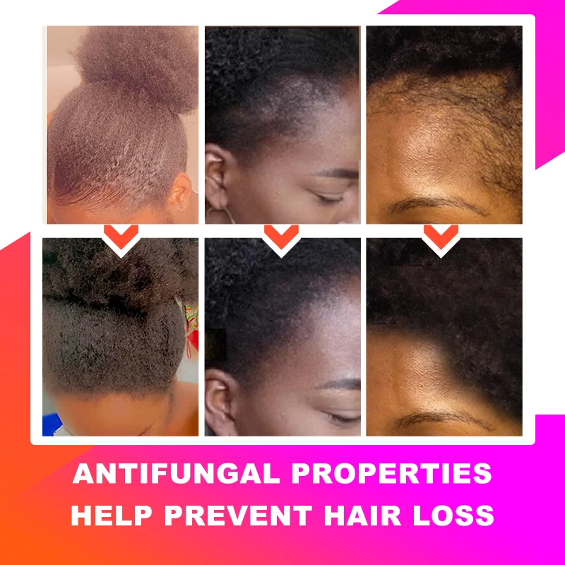 Ensemble-de-traitement-de-croissance-rapide-des-cheveux-Priority-ich-Chebe-Spray-anti-chute-de-cheveux