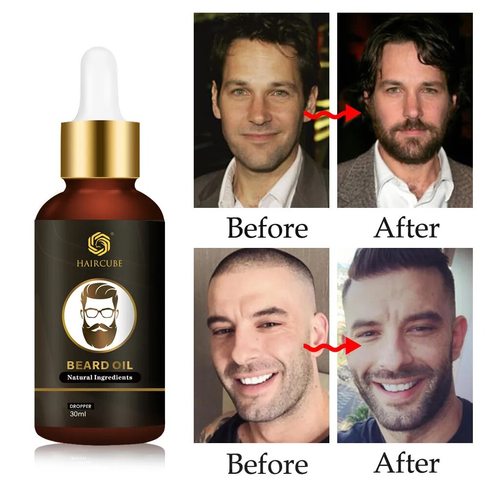 Huile-essentielle-de-croissance-de-la-barbe-pour-hommes-naturelle-efficace-paisse-nourrissante-soin-de-la