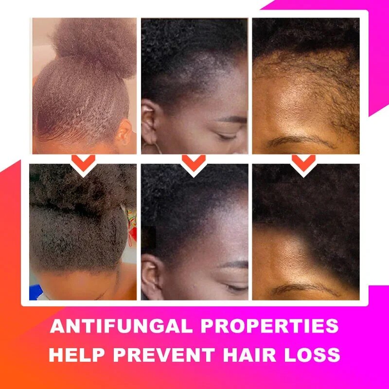 Ensemble-de-croissance-rapide-des-cheveux-l-huile-de-chebe-masque-capillaire-anti-perte-de-rupture
