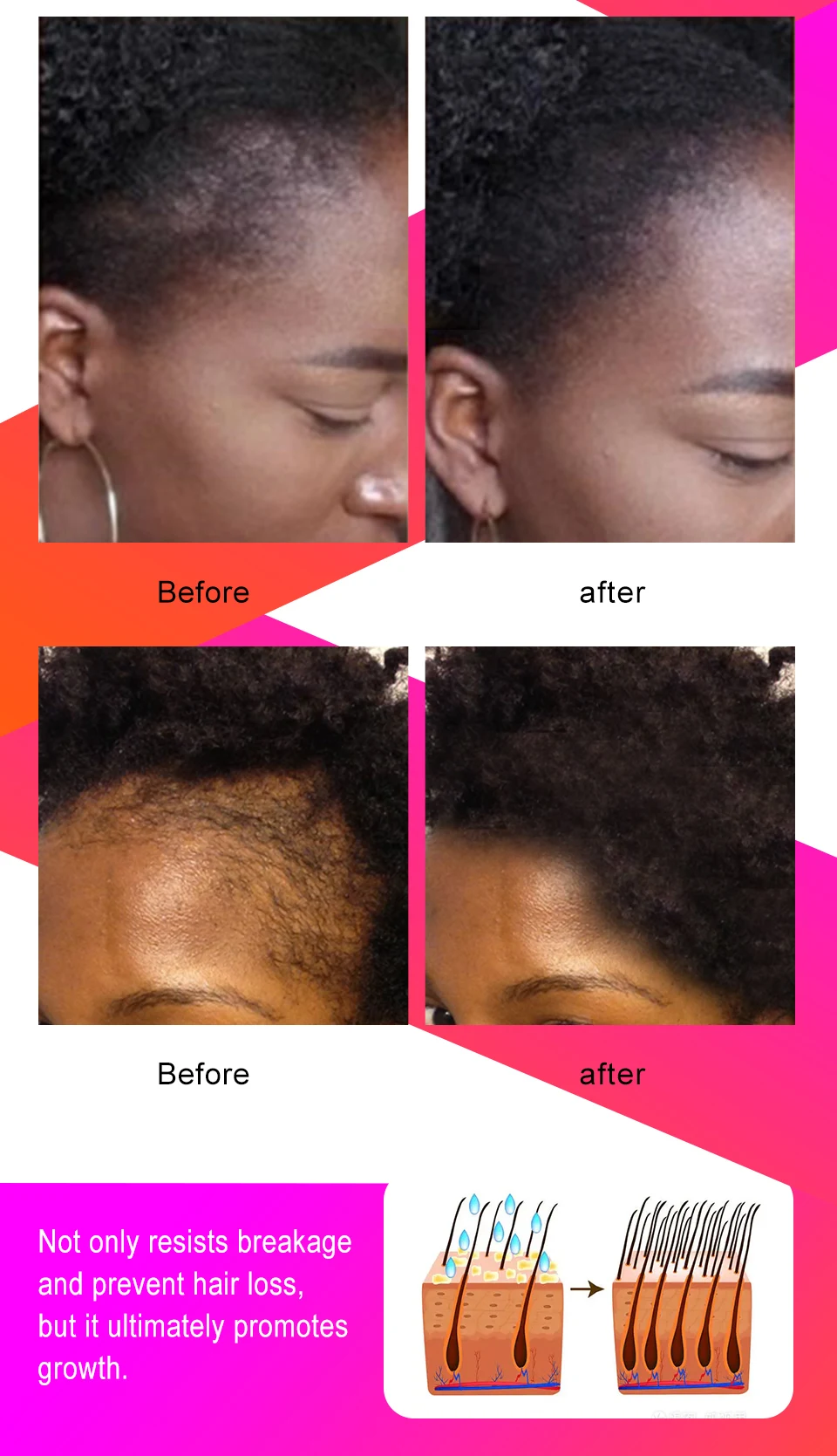 cheveux afro S1ee325e861804f4a98d76aeb992d66dft