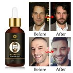 Huile-essentielle-de-croissance-de-la-barbe-pour-hommes-naturelle-efficace-paisse-nourrissante-soin-de-la