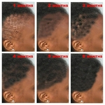 S-rum-pour-la-croissance-rapide-des-cheveux-traitement-l-huile-essentielle-pr-vention-de-la