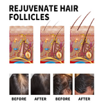 repousse cheveux S95d67eb1bcf1482497eeda5f3d90e9218
