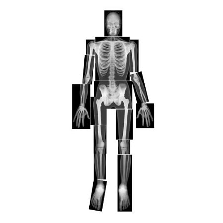 radiographie-x-rays-roylco-corps-humain-montessori-reggio-education