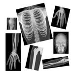 radiographie-x-rays-roylco-corps-humain-squelette-education