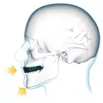 protege_dents_shock_doctor_transparent