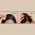 cheveux avant après pellicules