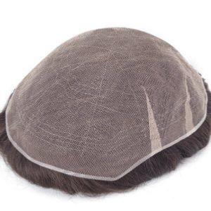 French-Lace-Toupee-zoom