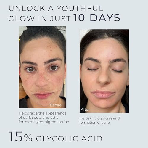 InstaSkincare Glycolic Acid Serum for Face 15% Strength - Extra Large Size (8Oz) - Advanced Formula for Enhancing Skin Radiance, Texture Improvement, Addressing Uneven Tone & Fine Lines