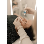 Gros plan dune personne recevant un traitement de beauté par microneedling dans une clinique