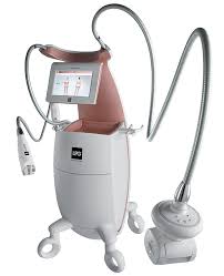 lpg