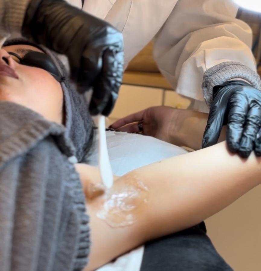 EPILATION LASER PARIS