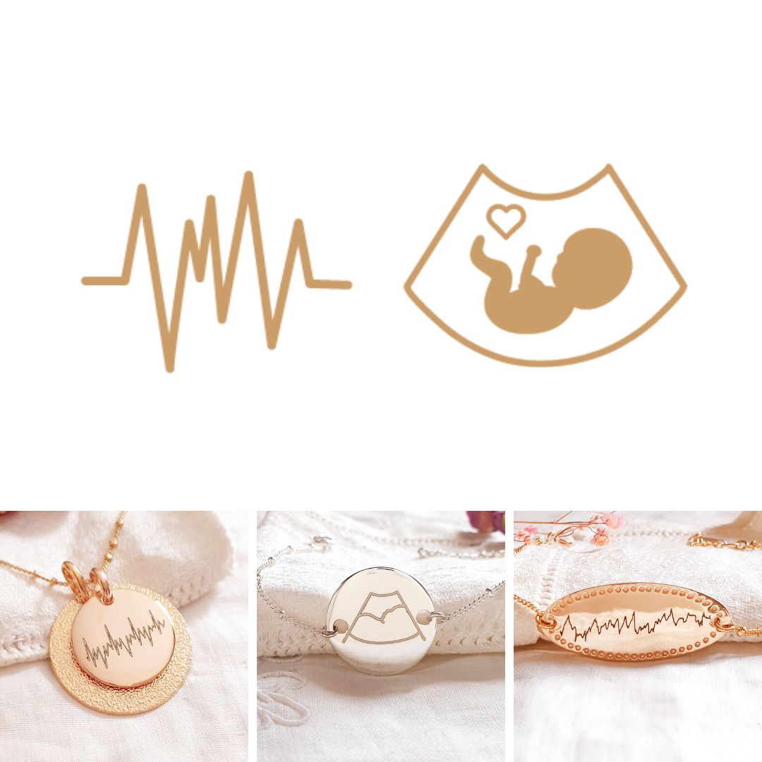 Graver votre MONITORING ou ECHOGRAPHIE