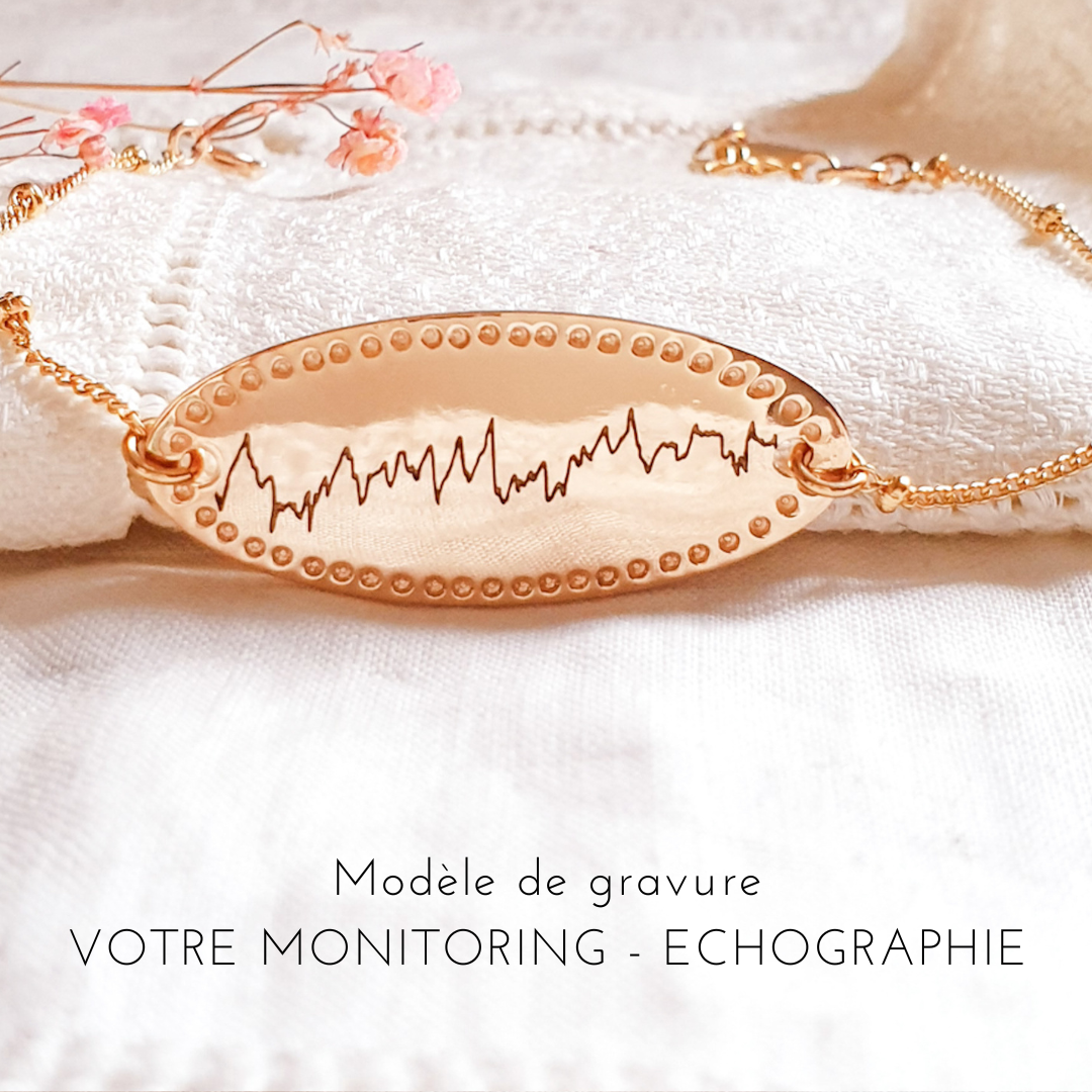 bijou monitoring