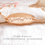 bijou-monitoring