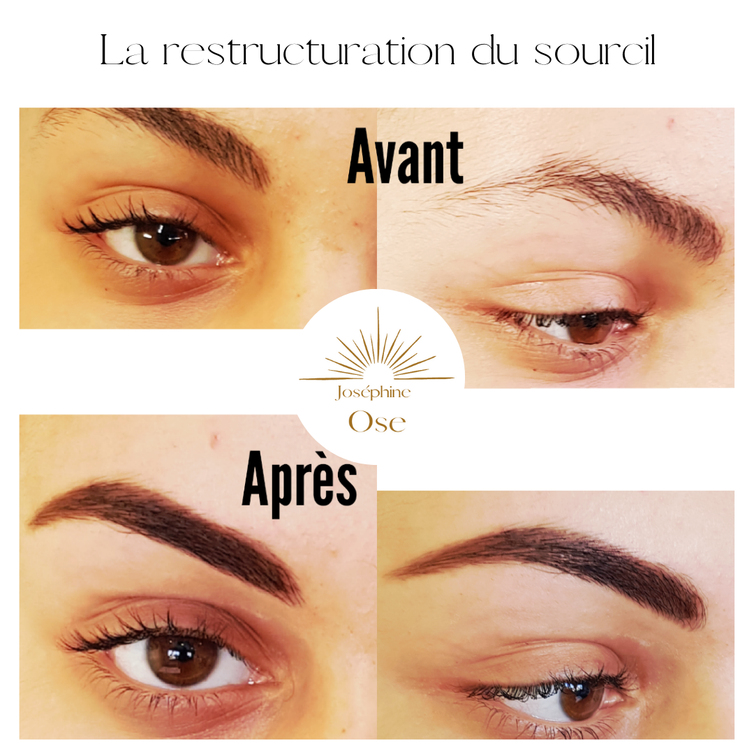 la restructuration du sourcil