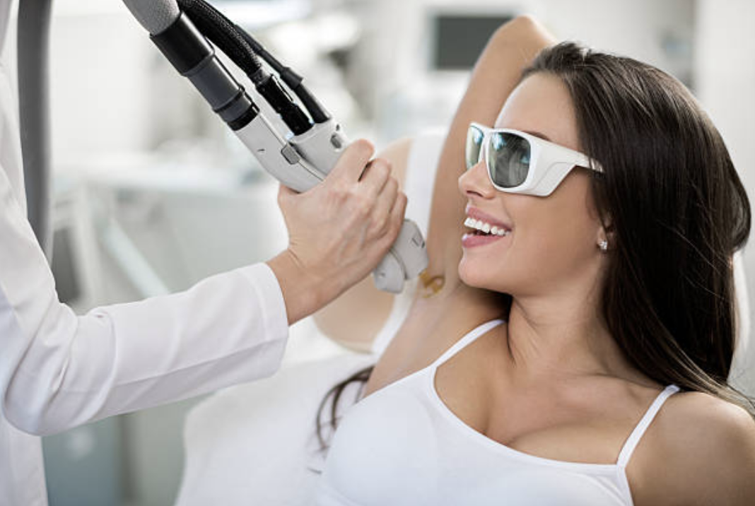 Epilation laser