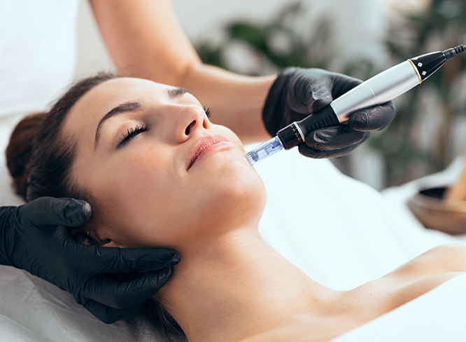 microneedling 1