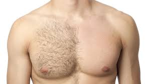Epilation à la cire méthode Epiloderm