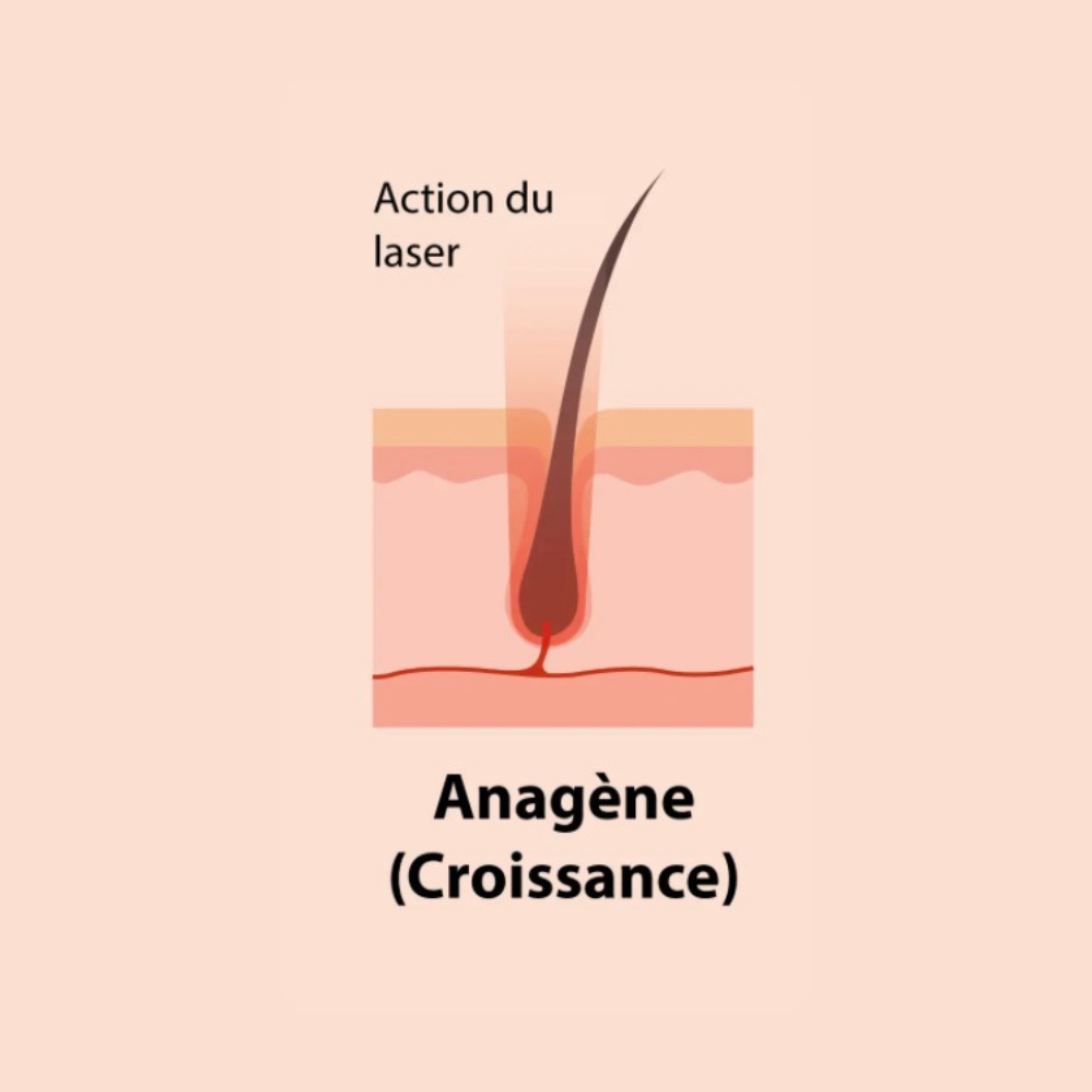 anagene
